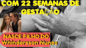 Whindersson nunes abre o jogo sobre planos para parto e conta detalhes da criação do filho. Oe7j7ix Hvnzjm