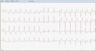 Auch ist diese untersuchung das geeignete verfahren. Ekg Tierarztliche Klinik Oberhaching