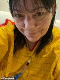 Coronavirus US: Wisconsin woman, 52, has double lung transplant