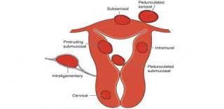 Also, see if you ca. Gynecology What Do You Know About Pelvic Mass Trivia Questions Quiz Proprofs Quiz