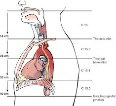 Image result for esophagus
