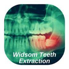 6 replacing an extracted tooth. Emergency Tooth Extraction Near Me 24 7 No Insurance Ok