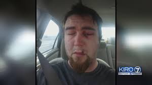 Everett man recovering after attacked while trick-or-treating with his kids 