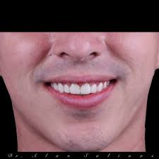 Alan Salinas Odontologia