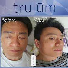 Jual Trulum Skincare Di Tugujaya Wa 0811 233 8376 Trulum Merupakan Produk Skincare Perawatan Wajah Terlaris Abad Ini Yan Perawatan Wajah Obat Jerawat Jerawat