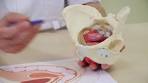 Wat is een verzakking? - YouTube