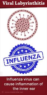 Image result for Acute Labyrinthitis