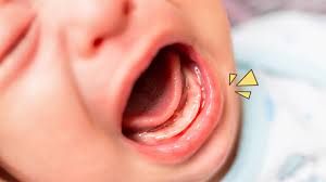 Jika bayi tidak mau makan saat tumbuh gigi, sebaiknya jangan dipaksa. Resepi Makanan Bayi 9 Bulan Belum Tumbuh Gigi