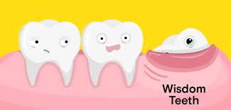 Having a sore wisdom tooth can be debilitating. How To Cope With Pain From Erupting Wisdom Teeth Waltham Ma