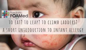 If baby's allergy to cow's milk protein. To Eat To Leap To Climb Ladders A Peek Into The World Of Infant Allergy Paediatricfoam