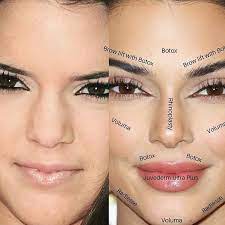 What Did Kendall Have Done Here Are Some Possibilities Agree What Did Ken Kendall Jenner Sem Maquiagem Cirurgia Plastica De Celebridade Cirurgia Plastica