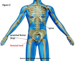 Icd 9 Cm Icd 10 Cm Codes Bmus The Burden Of Musculoskeletal Diseases In The United States