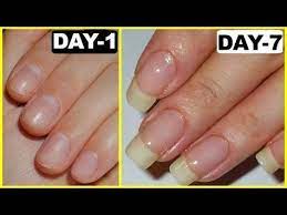 Naturally Grow Your Nails Faster Within A Week Easy Effective Home Remedy Youtube How To Grow Nails Nail Growth Tips Make Nails Grow