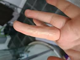 Learn about pregnancy · hope and support · women just like you Is This Early Pregnancy Cervical Mucus Photos