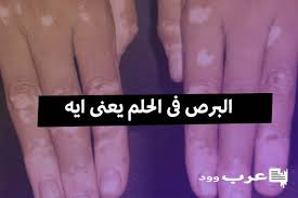 تفسير حلم من رأى انه يأكل لحم البقر ، رؤيا اكل لحوم بقر في المنام : ØªÙØ³ÙŠØ± Ø±Ø¤ÙŠØ© Ø¨Ù‚Ø±Ø© ØªÙ„Ø¯ ØªÙˆØ£Ù… ÙÙŠ Ø§Ù„Ù…Ù†Ø§Ù…