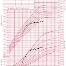 Growth Chart Of A Female Patient With Classic 21 Hydroxylase