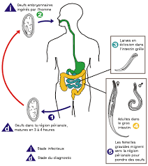 Le ver intestinal, également connu sous le nom de ver de siège ou filiforme, est un parasite intestinal humain, qui se trouve principalement chez les enfants. Oxyurose Wikipedia