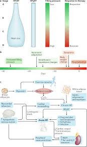 The Expanding Role Of Implantable Devices To Monitor Heart Failure And Pulmonary Hypertension Nature Reviews Cardiology