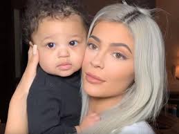 Cái môi trên của Kylie Jenner dài ra là do bơm môi quá đà hay là do mấy lần  sửa mũi của cô ấy vậy? : r/Splendida