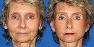 Dr. Timothy Marten is the Best