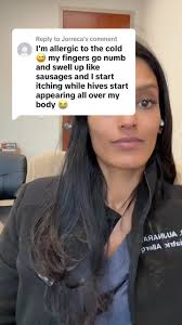 Replying to @Jorreca usually does get better with time #cold #urticaria  #doctor #allergy #epipen #pov #premed #itchy