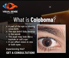 Image result for Coloboma