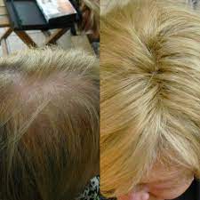 Microlines Von Hairdreams Hair Hair Styles Style