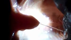 Maybe you would like to learn more about one of these? Inside A Mouth And Throat By Jason Mouth