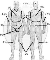 total body surface area tbsa calculate percentage of