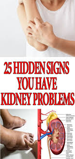Pin On Natural Remedies