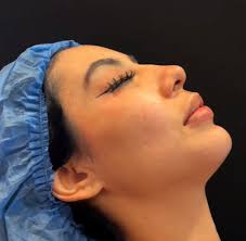 Dr. Javier Garnica (@drjaviergarnica) · Instagram 照片和视频