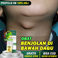 Check spelling or type a new query. Obat Benjolan Dibawah Dagu Tradisional Kelenjar Getah Bening Di Dekat Dagu Wajah Muka Sakit Penyakit Tumor Kutil Kulit Bentol Bengkak Tiroid Herbal Alami Propolis Sm Brazilian 100 Halal