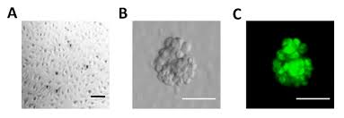 (changes are in italics.) stage ii: Modeling Ovarian Cancer Multicellular Spheroid Behavior In A Dynamic 3d Peritoneal Microdevice Protocol Translated To German