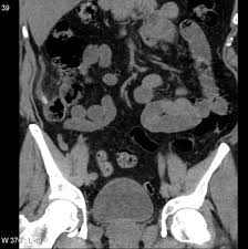Viewing Playlist Gastrointestinal Tract Ios Pack Radiopaedia Org The revolutionary new radiopad™ app allows you. radiopaedia org