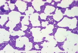 Image result for Group D Streptococcus