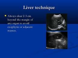 Liver Ultrasound Ultrasound Diagnostic Medical Sonography Medical Ultrasound