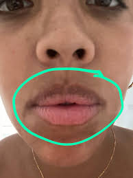 What could be causing my Golden Retriever's mouth itching and light spot?