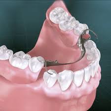 Eat soft foods like applesauce, mashed potatoes, yogurt, hot cereals, and. Partial Dentures Semidey Dental