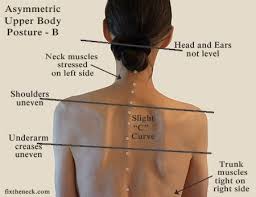 Pin On Upper Back Pain Relief