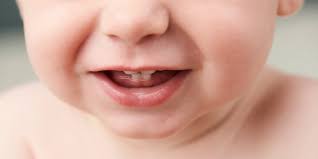 Check spelling or type a new query. Bercak Putih Pada Mulut Bayi Bisa Jadi Masalah Serius Parenting Dream Co Id