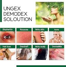 Image result for demodex rosacea
