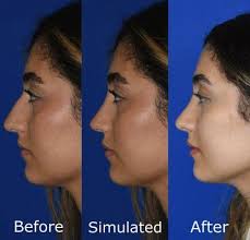 Tseng Plastic Surgery, 11415 Slater Ave NE, Ste 104, Kirkland, WA 98033, US 