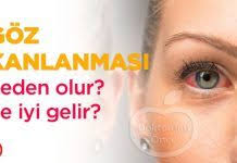 Goz Kanlanmasi Neden Olur Ne Iyi Gelir Sundhed