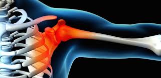 Shoulder pain at night or shoulder pain from sleeping can be troublesome. What S Causing My Shoulder Blade Pain 15 Causes Pain Doctor