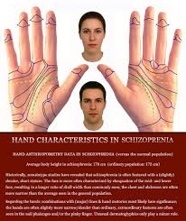 Palm Reading Schizophrenia The Hand System Phantom