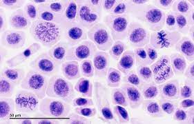 During telophase the nuclear membrane splits.during prophase the chromosomes go to separate sides of the cell.during telophase the nuclear cell membrane animal cells are circular, and plant cells are rectangular. File Mitosis 261 13 Pressed Root Meristem Of Onion Cells In Prophase Metaphase Anaphase Telophase Jpg Wikibooks Open Books For An Open World