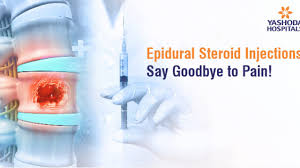 Epidural Steroid Injections : Say Goodbye to Pain! - Yashoda Hospiatals