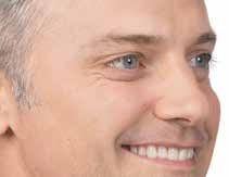 Tick Tactics Cosmetic Procedures With Zero Downtime