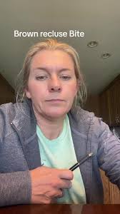 What to Do If Your Dog Gets Bit by A Brown Recluse Spider in The inside of  Her Paw