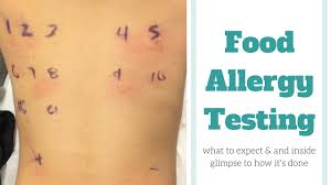 Sometimes, an allergy blood test may be used. Food Allergy Testing Youtube